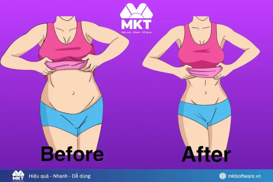 Before–after giảm cân