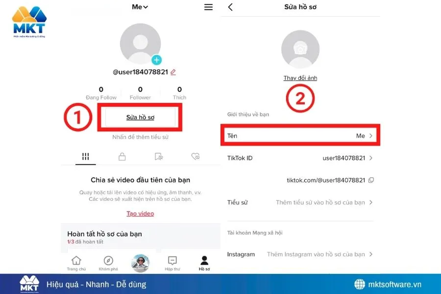 Cách đổi tên Tiktok trên điện thoại đơn giản nhất